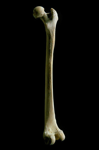 Femur Bone Photo: Fine Art Print of Human Femur Anatomy | RedKalion