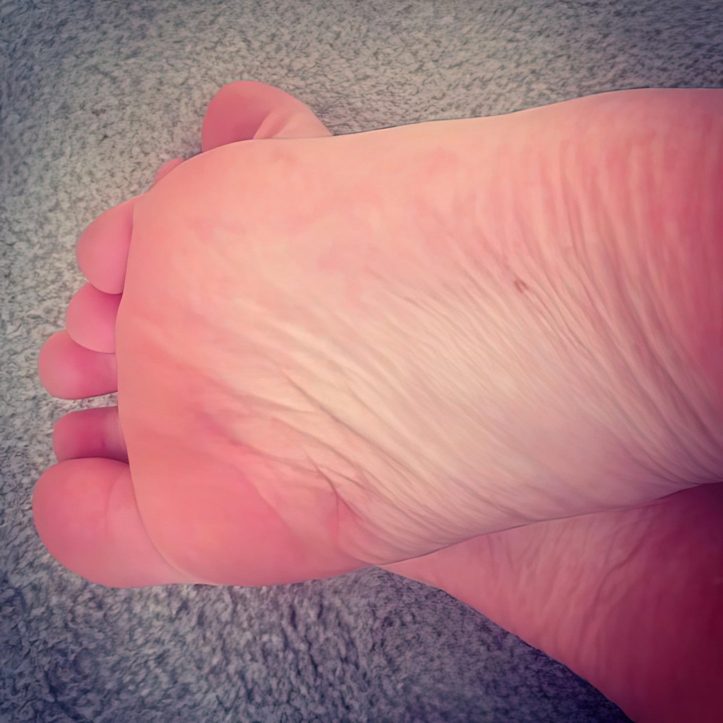 Freckle Foot Art Print | Museum-Quality Fine Art Print | RedKalion