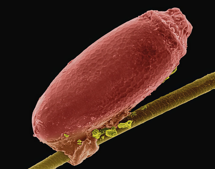 Louse Egg Case Attached To A Hair Art Print | RedKalion